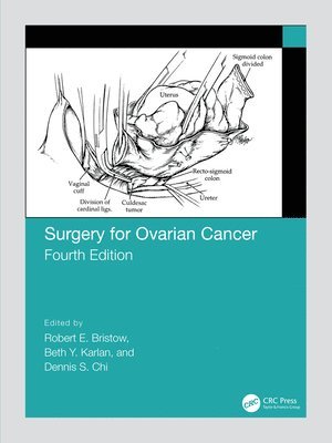 Surgery for Ovarian Cancer 1