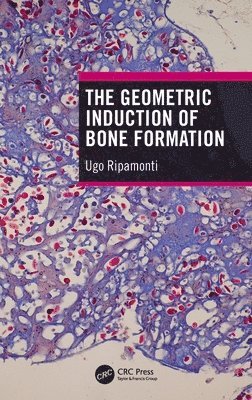 The Geometric Induction of Bone Formation 1