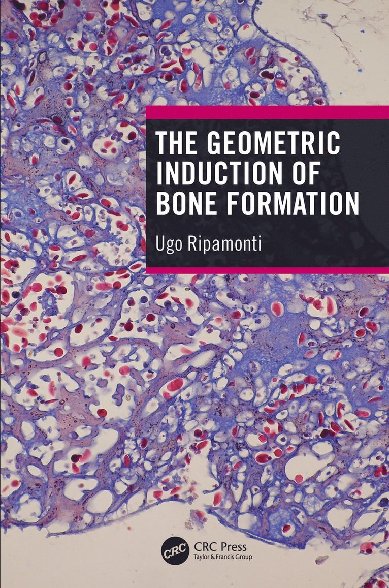 The Geometric Induction of Bone Formation 1