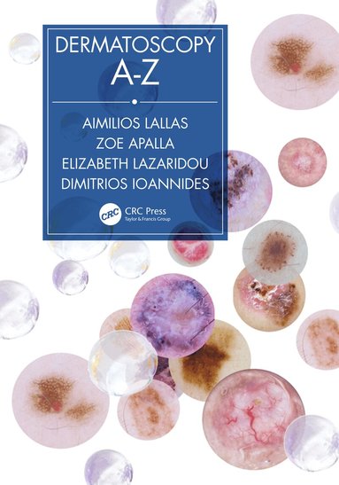 Aimilios Lallas, Zoe Apalla, Elizabeth Lazaridou, Dimitrios Ioannides - Dermatoscopy A-Z, Inbunden