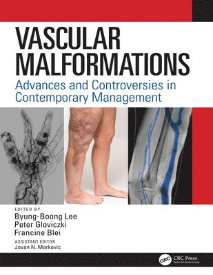 Vascular Malformations 1