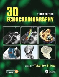 bokomslag 3D Echocardiography