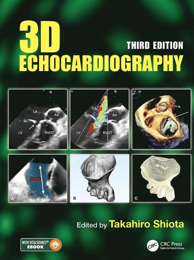 bokomslag 3D Echocardiography