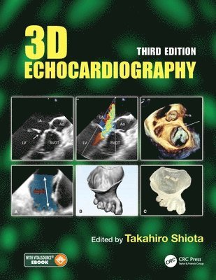 3D Echocardiography 1