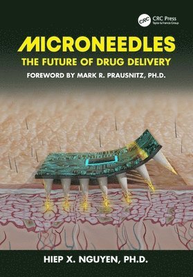 Microneedles 1