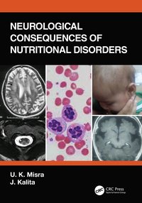 bokomslag Neurological Consequences of Nutritional Disorders