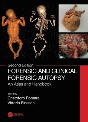 bokomslag Forensic and Clinical Forensic Autopsy