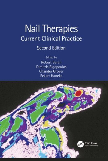 Robert Baran, Dimitris Rigopoulos, Chander Grover, Eckart Haneke - Nail Therapies, Inbunden