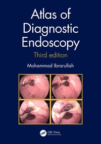 bokomslag Atlas of Diagnostic Endoscopy, 3E