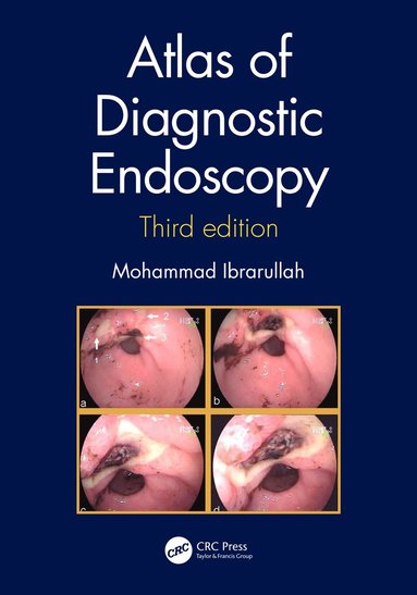 bokomslag Atlas of Diagnostic Endoscopy, 3E