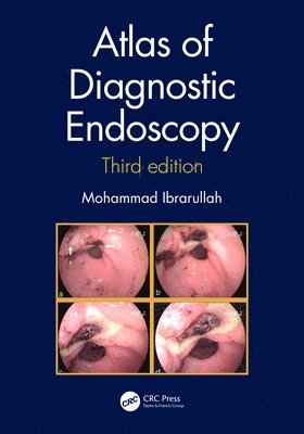 Atlas of Diagnostic Endoscopy, 3E 1