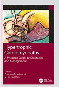 bokomslag Hypertrophic Cardiomyopathy