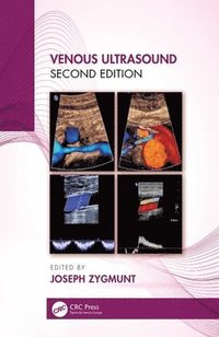 bokomslag Venous Ultrasound