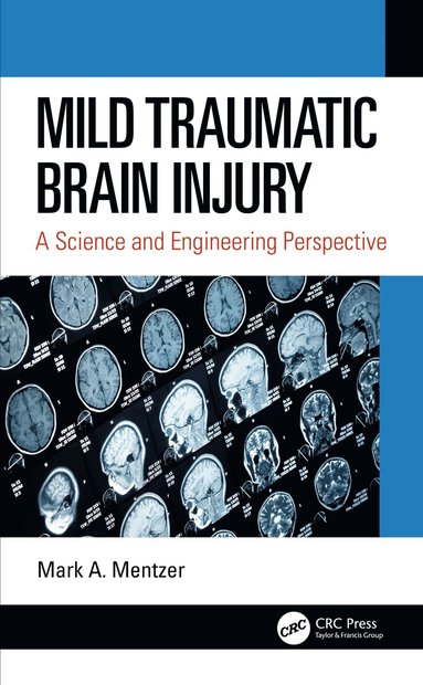 bokomslag Mild Traumatic Brain Injury