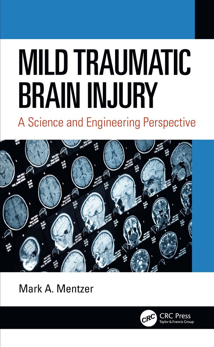 Mark A. Mentzer, USA) Mentzer, Mark A. (U.S. Army Research Laboratory, Aberdeen Proving Ground, Maryland - Mild Traumatic Brain Injury, Inbunden