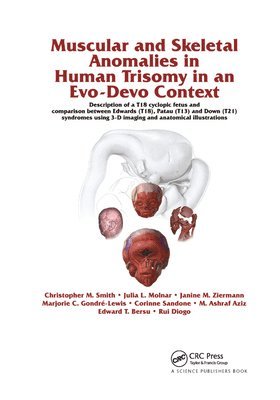 Muscular and Skeletal Anomalies in Human Trisomy in an Evo-Devo Context 1