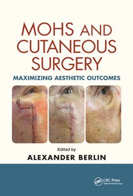 Alexander Berlin - Mohs and Cutaneous Surgery, Häftad