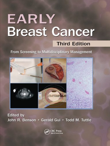 bokomslag Early Breast Cancer