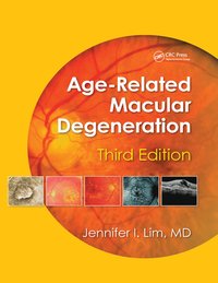 bokomslag Age-Related Macular Degeneration, Third Edition