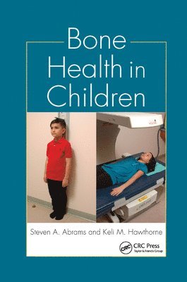 Steven A. Abrams, Keli M. Hawthorne - Bone Health in Children, Häftad