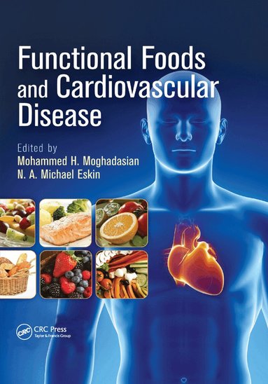 Mohammed H. Moghadasian, N.A. Michael Eskin - Functional Foods and Cardiovascular Disease, Häftad