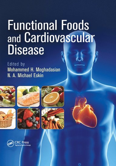 bokomslag Functional Foods and Cardiovascular Disease