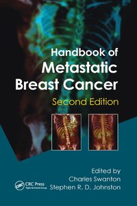 bokomslag Handbook of Metastatic Breast Cancer