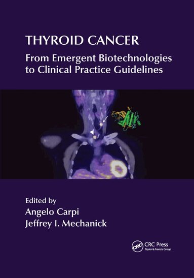 Angelo Carpi, Jeffrey I Mechanick - Thyroid Cancer, Häftad