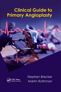 bokomslag Clinical Guide to Primary Angioplasty