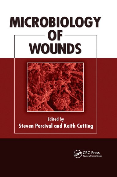 bokomslag Microbiology of Wounds