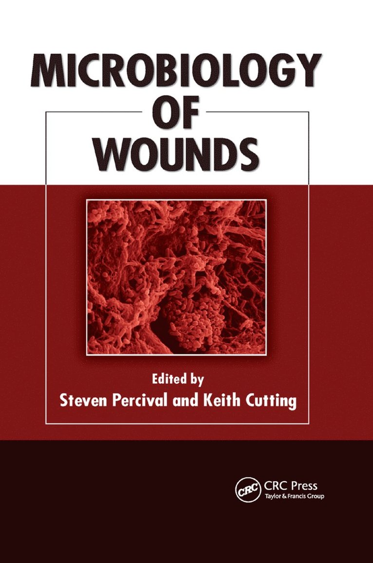 Microbiology of Wounds 1