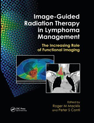 Roger M. Macklis, Peter S. Conti - Image-Guided Radiation Therapy in Lymphoma Management, Häftad