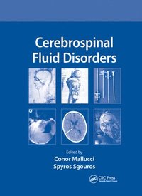 bokomslag Cerebrospinal Fluid Disorders