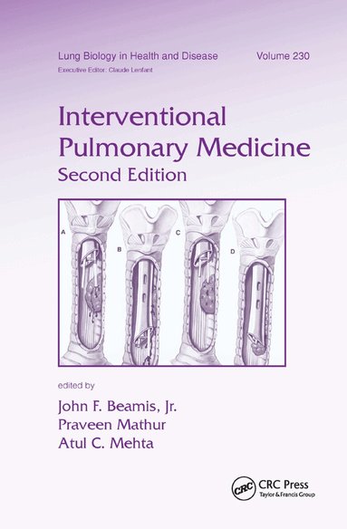 John F. Beamis, Jr., Praveen Mathur, Atul C. Mehta - Interventional Pulmonary Medicine, Häftad