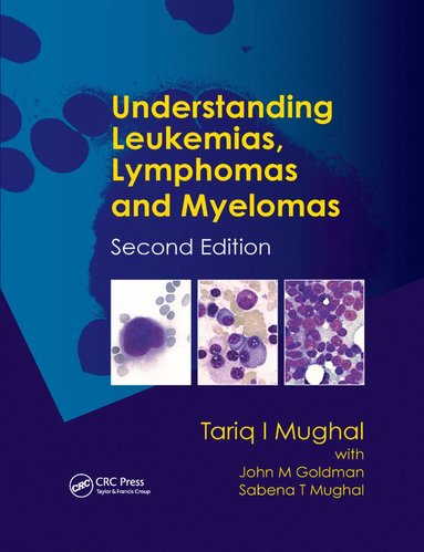 bokomslag Understanding Leukemias, Lymphomas and Myelomas