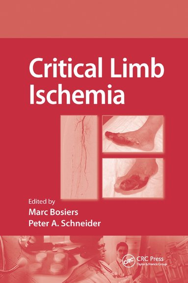 bokomslag Critical Limb Ischemia