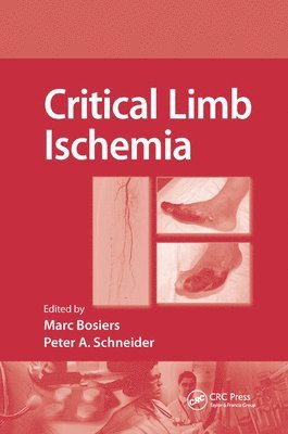 Critical Limb Ischemia 1