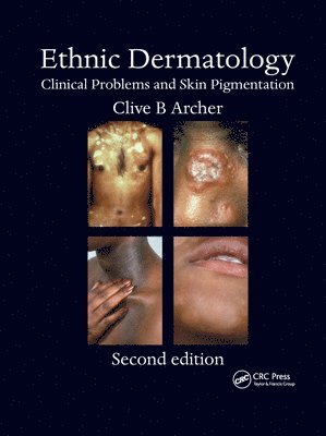 bokomslag Ethnic Dermatology