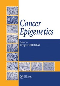 bokomslag Cancer Epigenetics