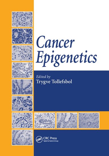 bokomslag Cancer Epigenetics