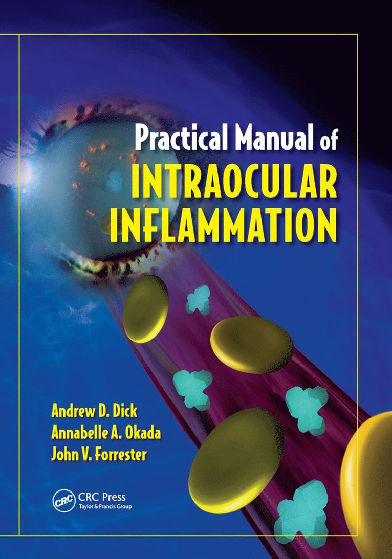 Andrew Dick, Annabelle Okada, John Forrester, UK) Dick, Andrew (Bristol Eye Hospital, Bristol, Avon, England, Japan) Okada, Annabelle (Kyorin University, Tokyo, UK) Forrester, John (Institute of Medical Sciences, Aberdeen, Scotland - Practical Manual of Intraocular Inflammation, Häftad