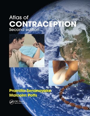 Atlas of Contraception 1