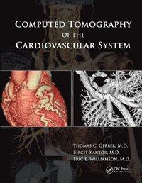 bokomslag Computed Tomography of the Cardiovascular System