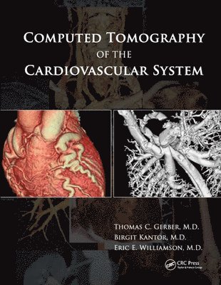 Computed Tomography of the Cardiovascular System 1