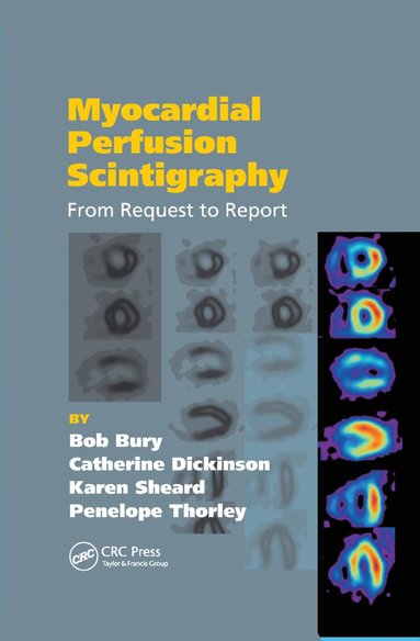 bokomslag Myocardial Perfusion Scintigraphy