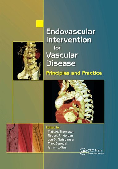 Matt M. Thompson, Robert A. Morgan, Jon S. Matsumura, Marc Sapoval, Ian M. Loftus - Endovascular Intervention for Vascular Disease, Häftad