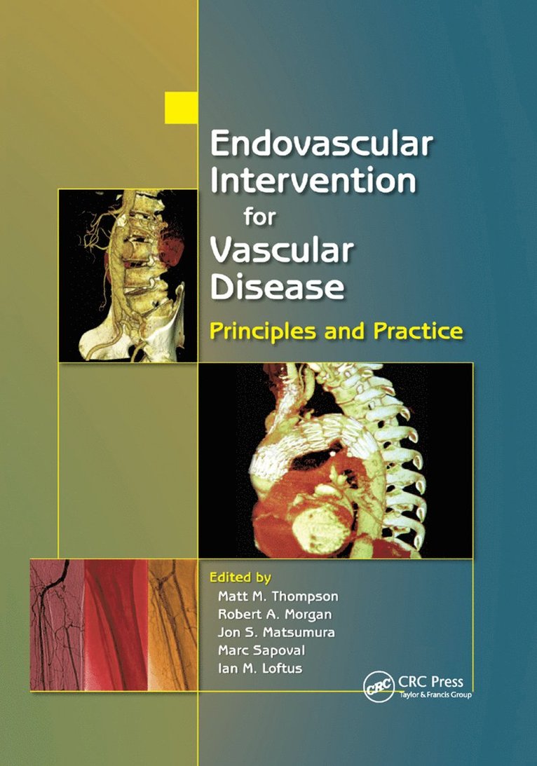 Endovascular Intervention for Vascular Disease 1