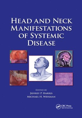 Jeffrey P. Harris, Michael H. Weisman - Head and Neck Manifestations of Systemic Disease, Häftad