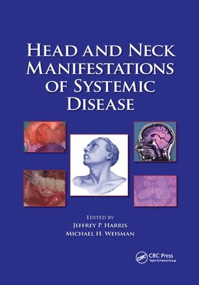 Head and Neck Manifestations of Systemic Disease 1