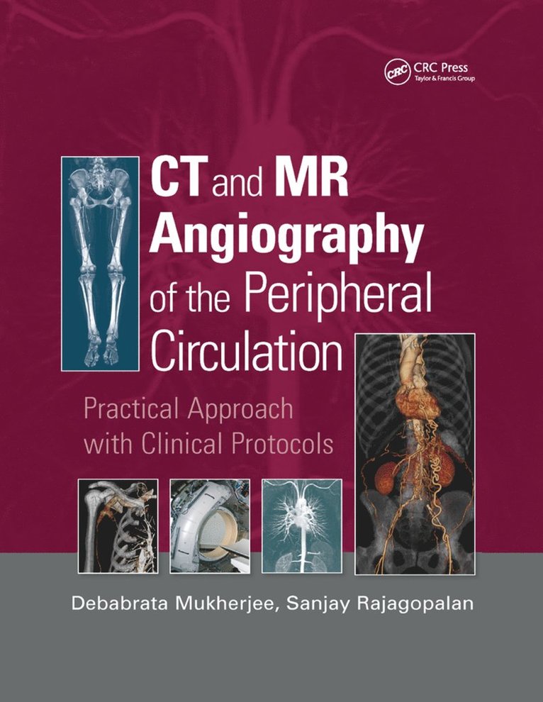 Debabrata Mukherjee, Sanjay Rajagopalan - CT and MR Angiography of the Peripheral Circulation, Häftad